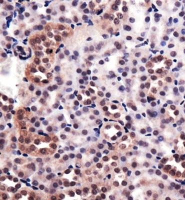 HMOX1 Antibody in Immunohistochemistry (Paraffin) (IHC (P))