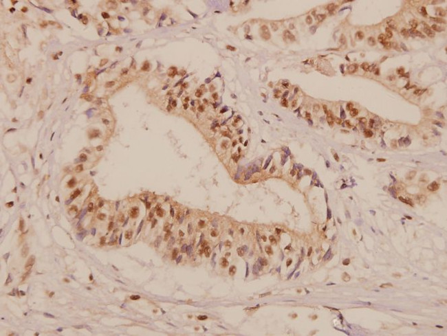 PMP22 Antibody in Immunohistochemistry (Paraffin) (IHC (P))