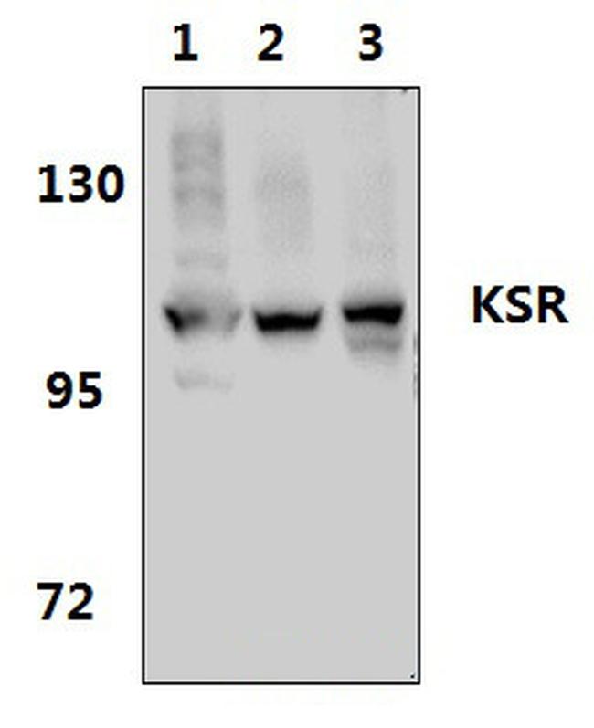 KSR1 Antibody in Western Blot (WB)