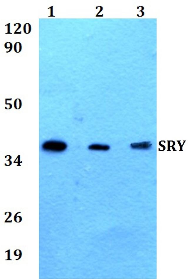 SRY Antibody in Western Blot (WB)