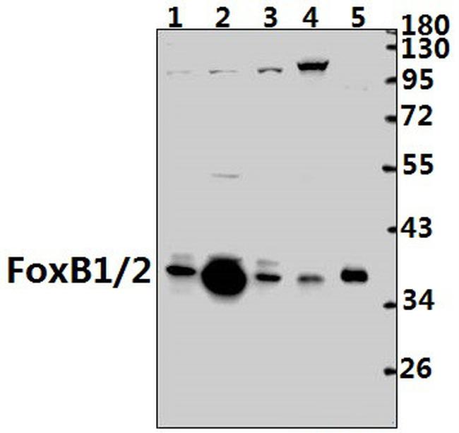 FOXB1/FOXB2 Antibody in Western Blot (WB)