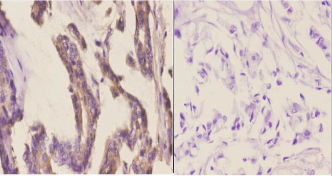 CYP2A13 Antibody in Immunohistochemistry (Paraffin) (IHC (P))