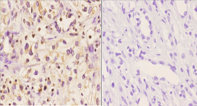 Myeloid Specific Antigen Antibody in Immunohistochemistry (Paraffin) (IHC (P))