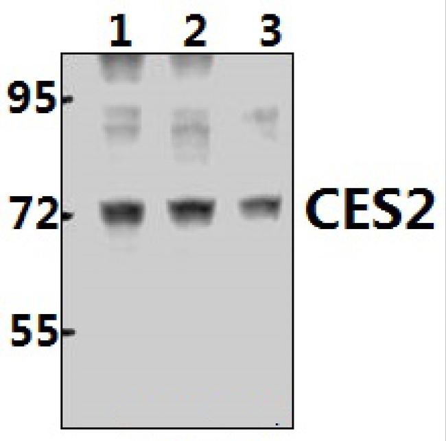 CES2 Antibody in Western Blot (WB)