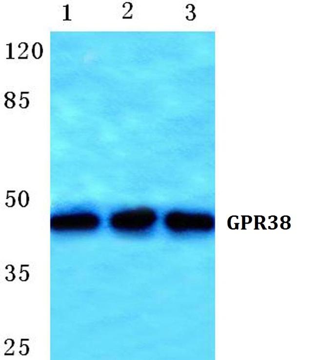 MLNR Antibody in Western Blot (WB)