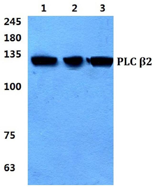 PLCB2 Antibody in Western Blot (WB)