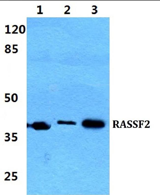 RASSF2 Antibody in Western Blot (WB)