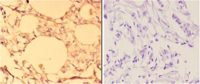 ABCC11 Antibody in Immunohistochemistry (Paraffin) (IHC (P))