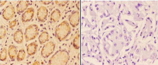 Angiopoietin 4 Antibody in Immunohistochemistry (Paraffin) (IHC (P))