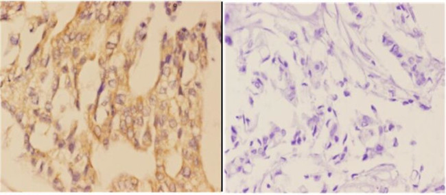 AANAT Antibody in Immunohistochemistry (Paraffin) (IHC (P))