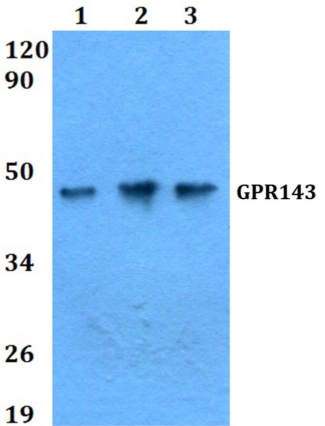 GPR143 Antibody in Western Blot (WB)