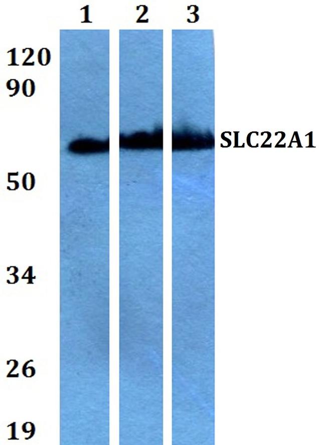 SLC22A1 Antibody in Western Blot (WB)