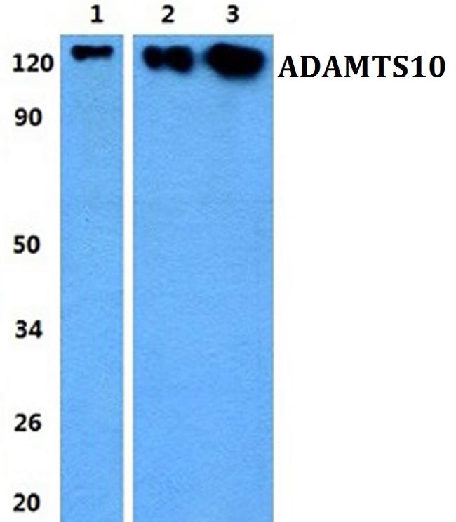 ADAMTS10 Antibody in Western Blot (WB)