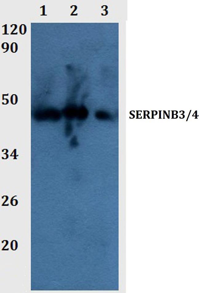 SERPINB3/SERPINB4 Antibody in Western Blot (WB)