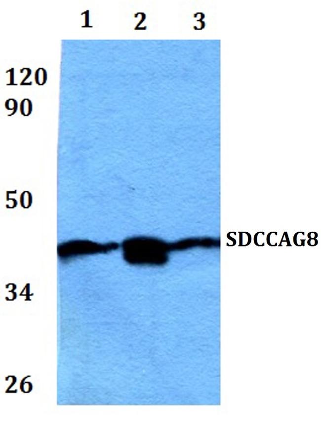 SDCCAG8 Antibody in Western Blot (WB)