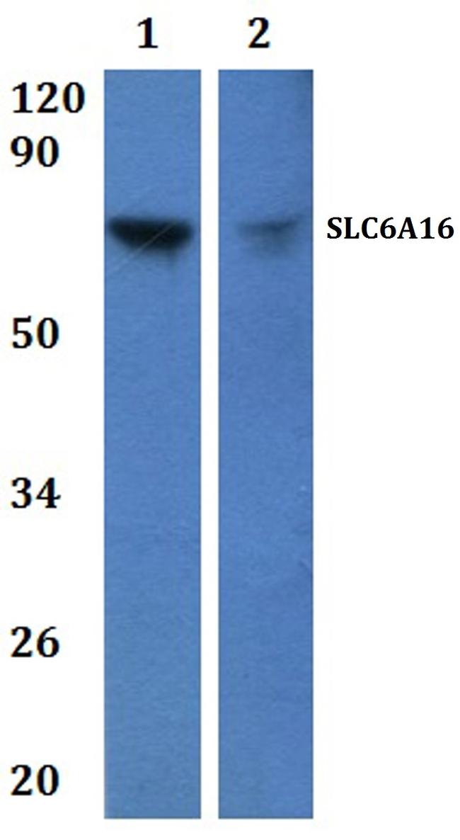 SLC6A16 Antibody in Western Blot (WB)
