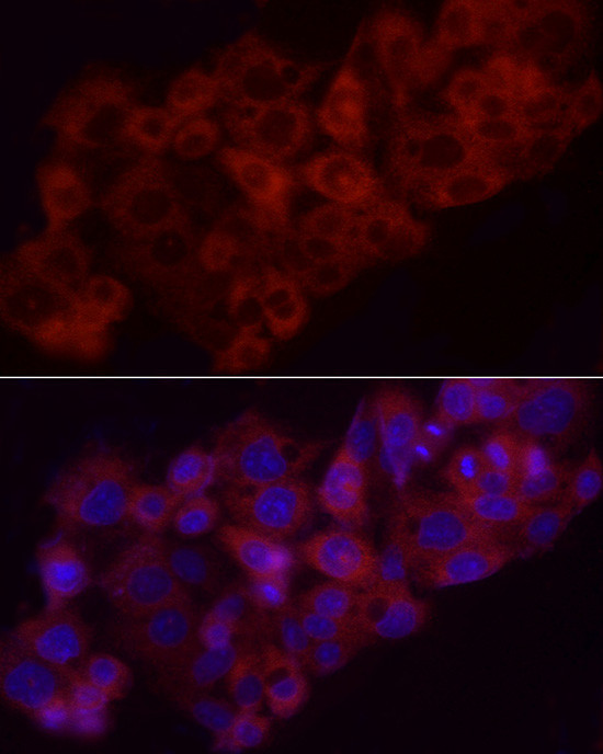 HMOX1 Antibody in Immunocytochemistry (ICC/IF)