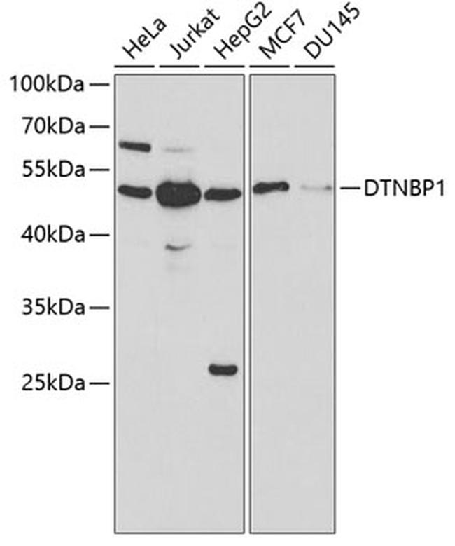 DTNBP1 Antibody in Western Blot (WB)