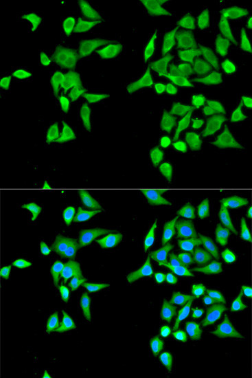 CES2 Antibody in Immunocytochemistry (ICC/IF)