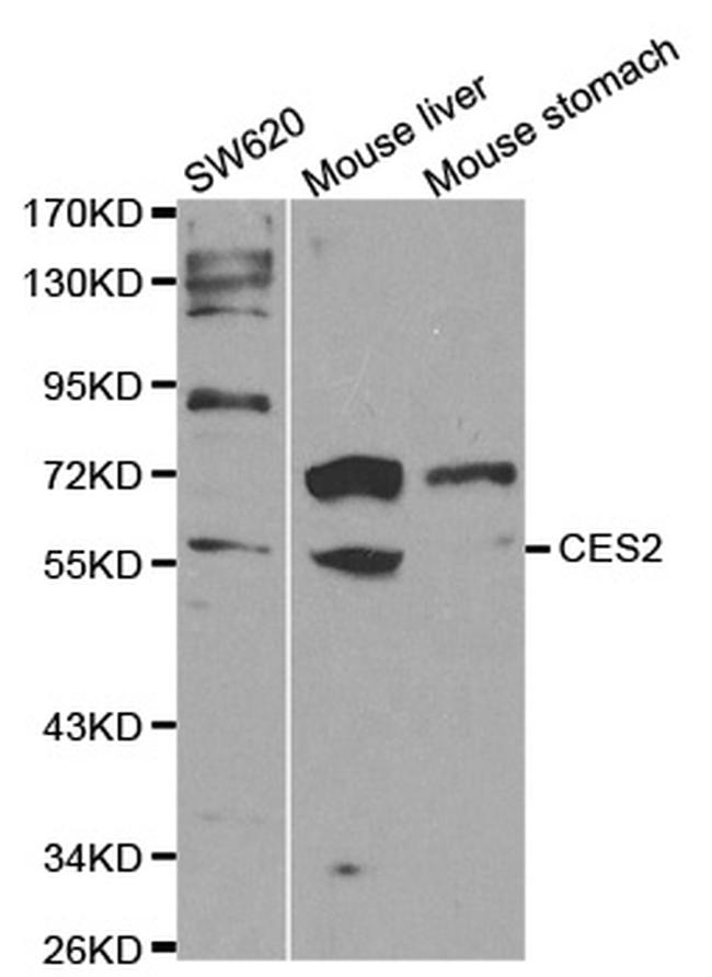 CES2 Antibody in Western Blot (WB)