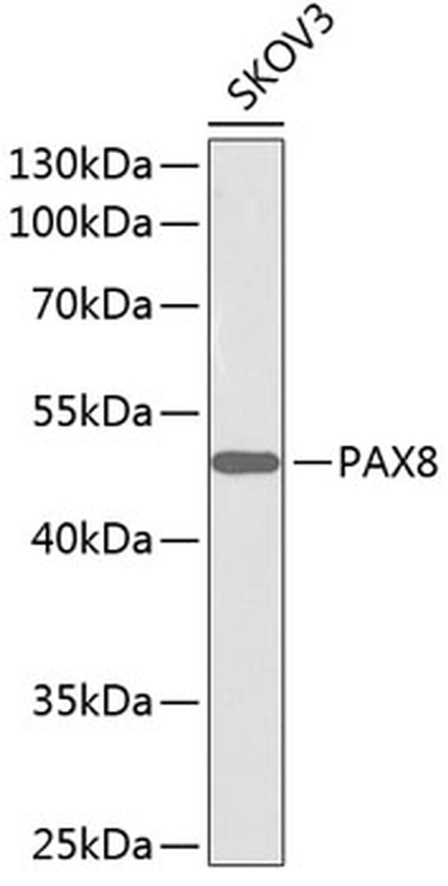 GNG7 Antibody in Western Blot (WB)