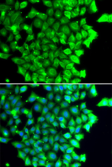 TRIAP1 Antibody in Immunocytochemistry (ICC/IF)