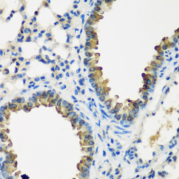 CYP2F1 Antibody in Immunohistochemistry (Paraffin) (IHC (P))