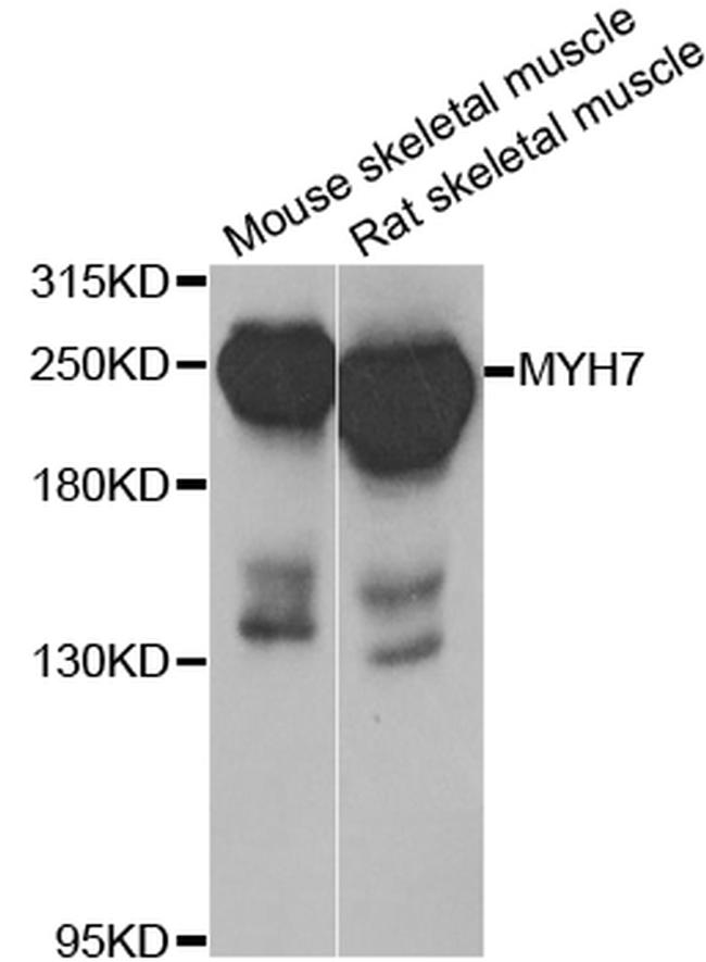 MYH7 Antibody in Western Blot (WB)