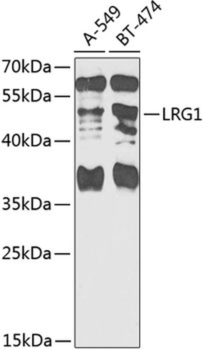 LRG1 Antibody in Western Blot (WB)