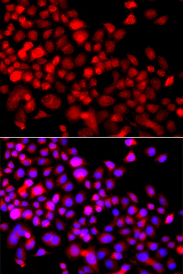 CALCOCO1 Antibody in Immunocytochemistry (ICC/IF)