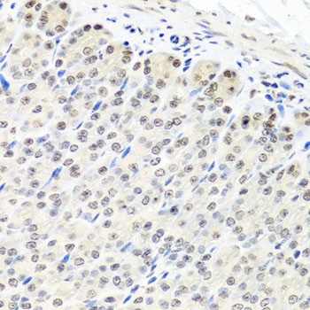 CNOT8 Antibody in Immunohistochemistry (Paraffin) (IHC (P))