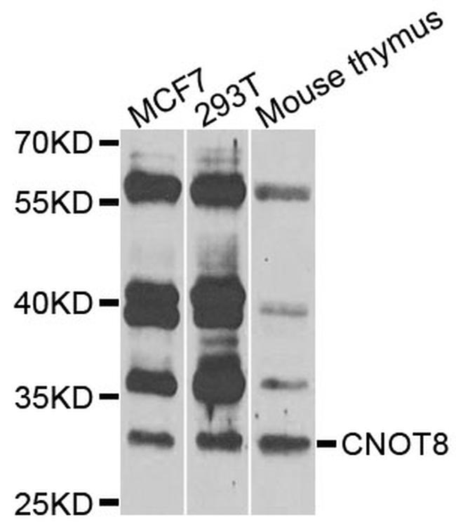 CNOT8 Antibody in Western Blot (WB)