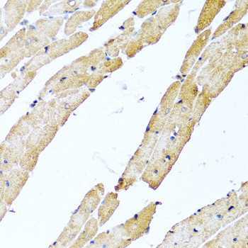 CALCB Antibody in Immunohistochemistry (Paraffin) (IHC (P))