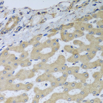 ATAD3B Antibody in Immunohistochemistry (Paraffin) (IHC (P))