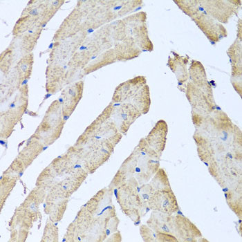 ATAD3B Antibody in Immunohistochemistry (Paraffin) (IHC (P))