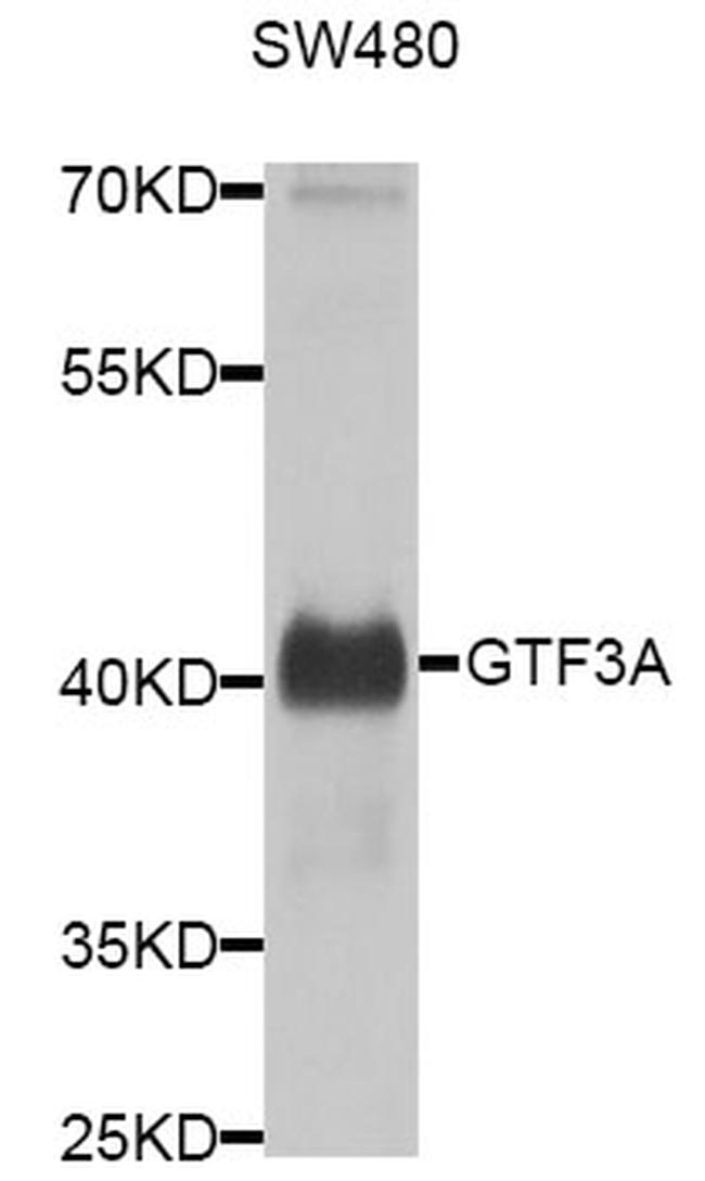 GTF3A Antibody in Western Blot (WB)