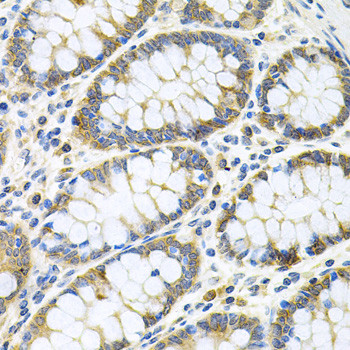 GNE Antibody in Immunohistochemistry (Paraffin) (IHC (P))