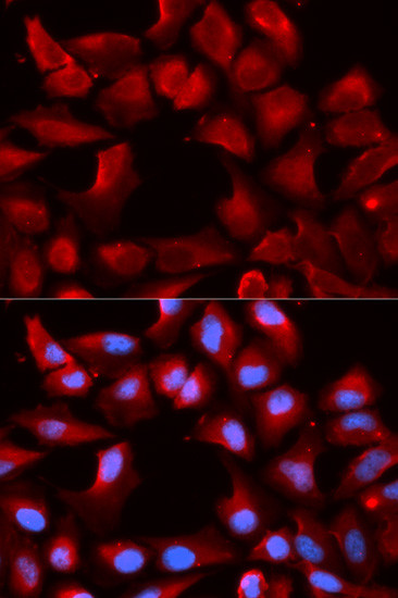 HSP40 Antibody in Immunocytochemistry (ICC/IF)