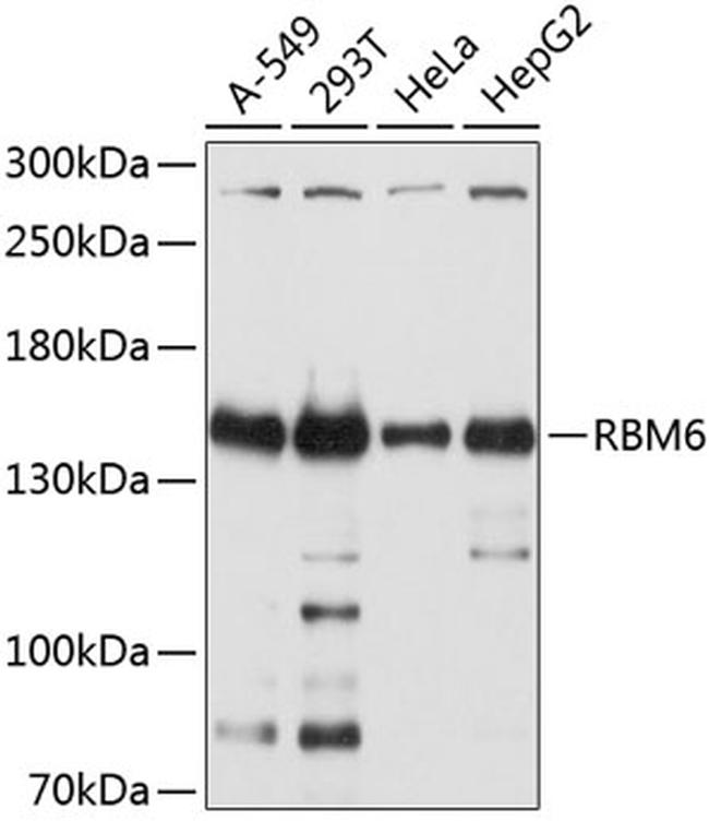 RBM6 Antibody in Western Blot (WB)