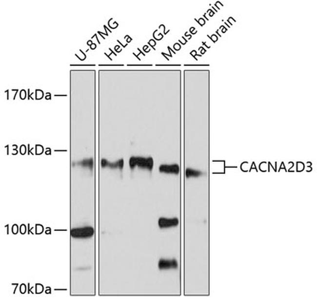 CACNA2D3 Antibody in Western Blot (WB)
