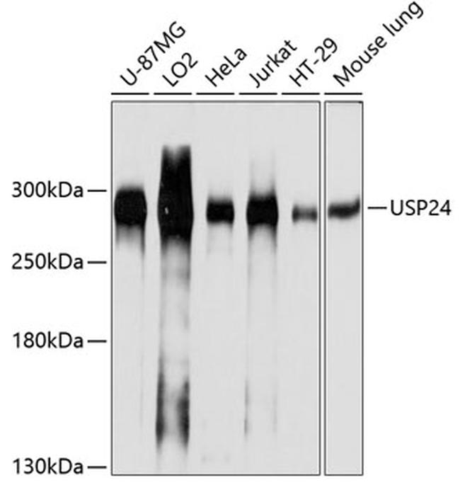 USP24 Antibody in Western Blot (WB)