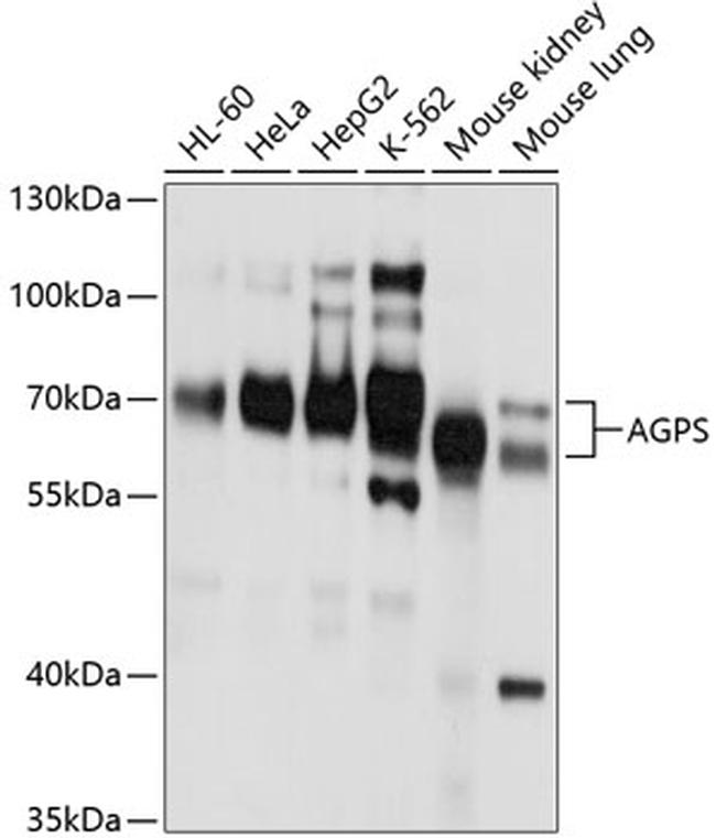 AGPS Antibody in Western Blot (WB)