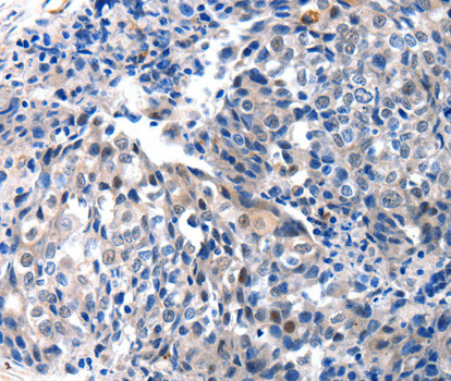 IGFBP7 Antibody in Immunohistochemistry (Paraffin) (IHC (P))