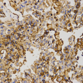 MRP5 Antibody in Immunohistochemistry (Paraffin) (IHC (P))