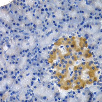 HSPB8 Antibody in Immunohistochemistry (Paraffin) (IHC (P))