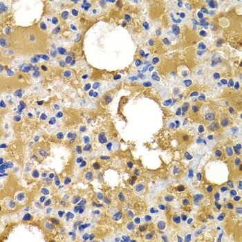 HSPB8 Antibody in Immunohistochemistry (Paraffin) (IHC (P))