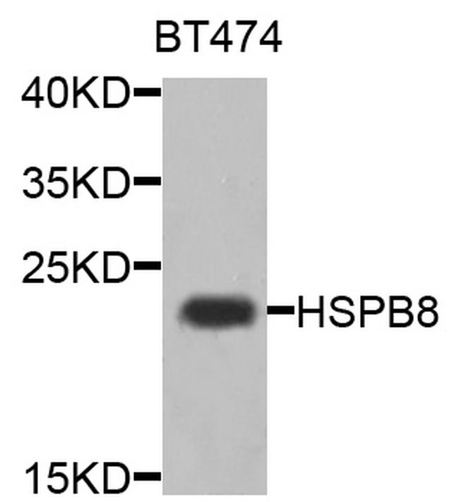 HSPB8 Antibody in Western Blot (WB)