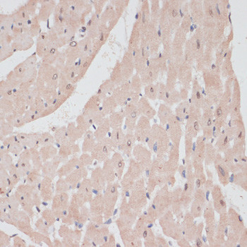 PRPF31 Antibody in Immunohistochemistry (Paraffin) (IHC (P))