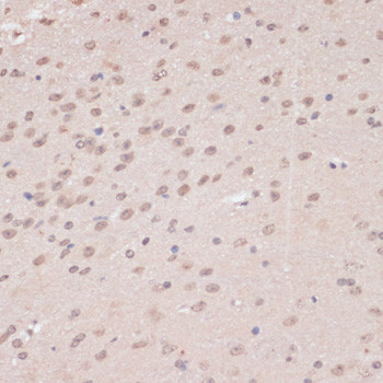 PRPF31 Antibody in Immunohistochemistry (Paraffin) (IHC (P))