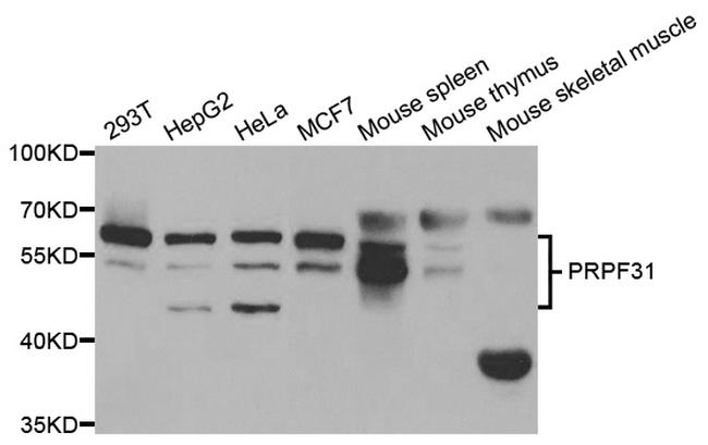 PRPF31 Antibody in Western Blot (WB)